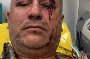 „Meg�llek!” - �v�lt�tt�k a fatolvajok, majd brut�lisan �sszevertek egy civil aktivist�t �s k�t �js�g�r�t az erd�ben